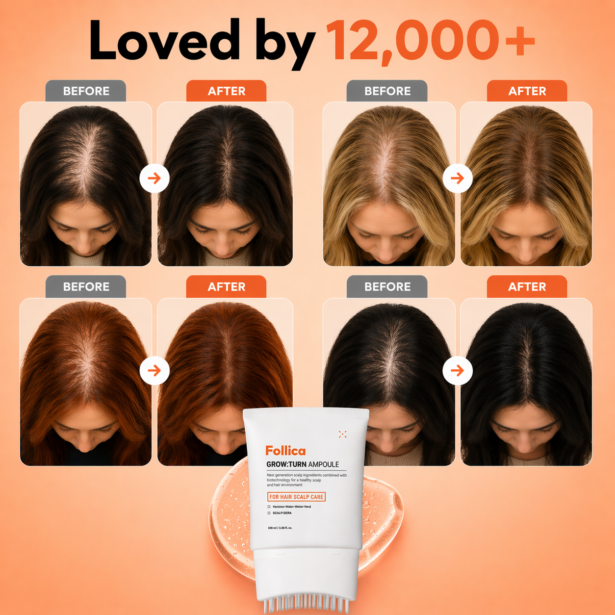 Follica Hair Growth Serum With Brush